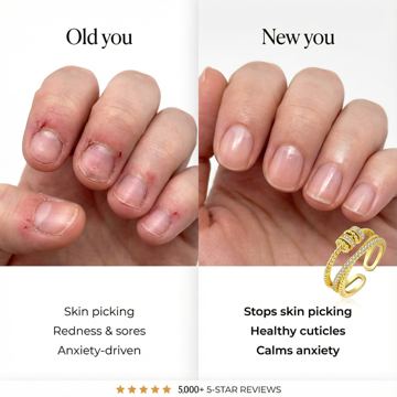 Orélina Jewelry ad — Spinning ring stops anxious habits and calms anxiety